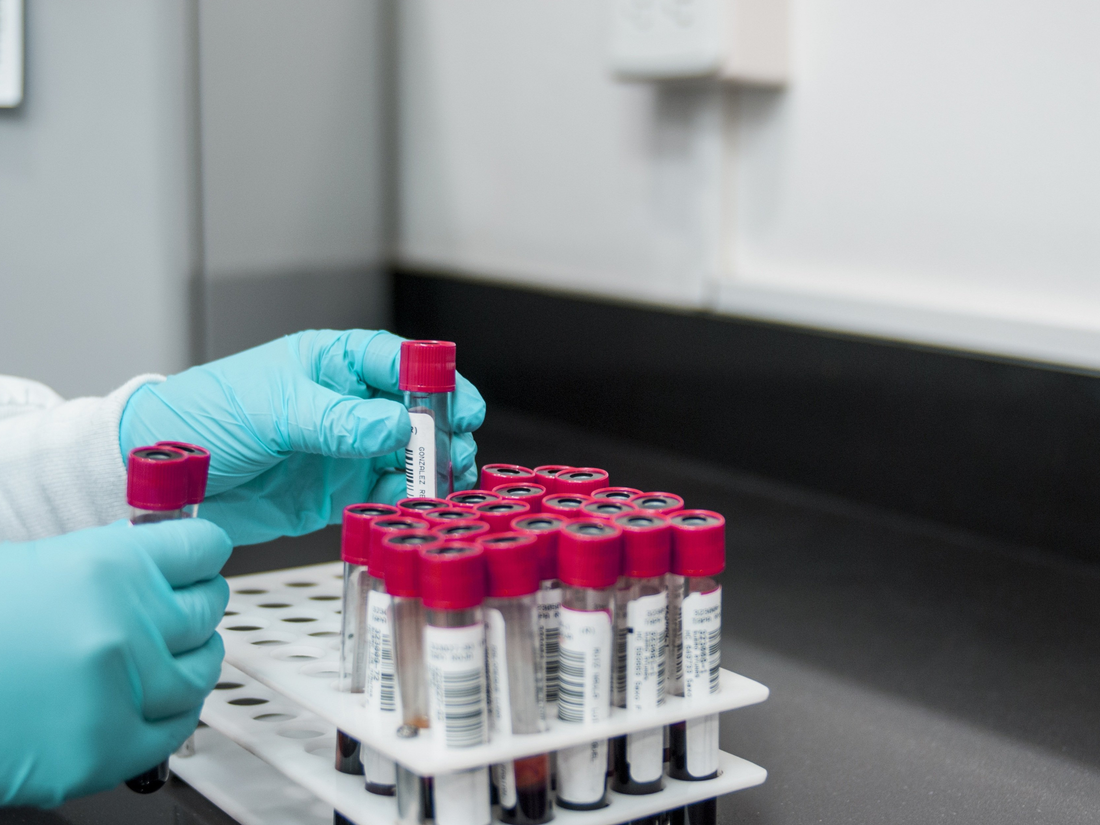 Understanding Your Blood Results: What They Really Mean